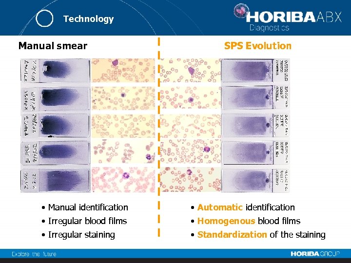 Technology Manual smear SPS Evolution • Manual identification • Automatic identification • Irregular blood