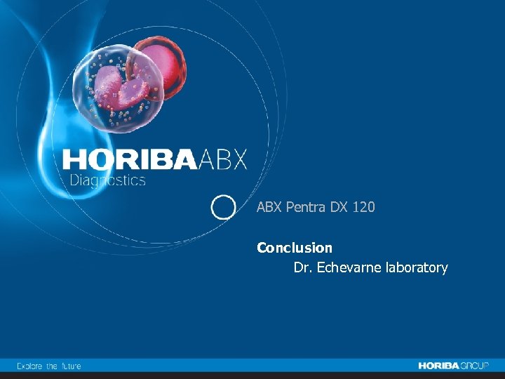 ABX Pentra DX 120 Conclusion Dr. Echevarne laboratory 