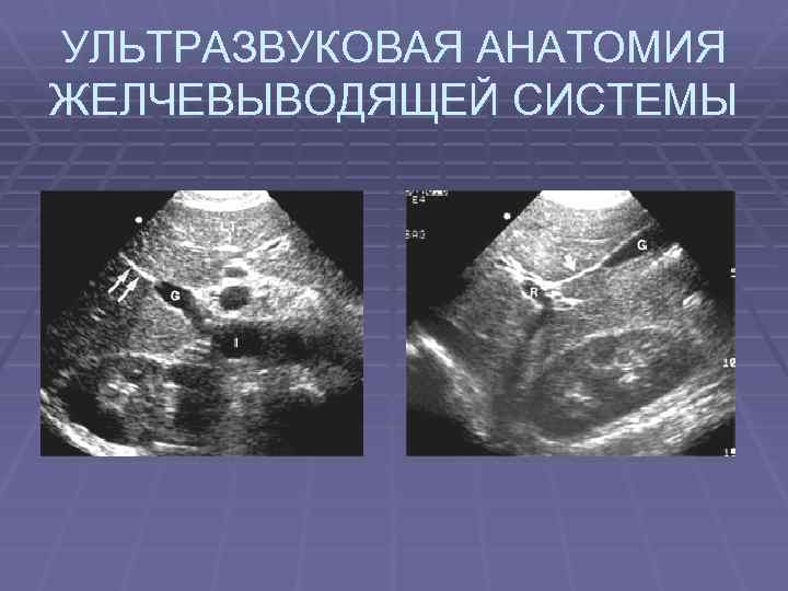 УЛЬТРАЗВУКОВАЯ АНАТОМИЯ ЖЕЛЧЕВЫВОДЯЩЕЙ СИСТЕМЫ 