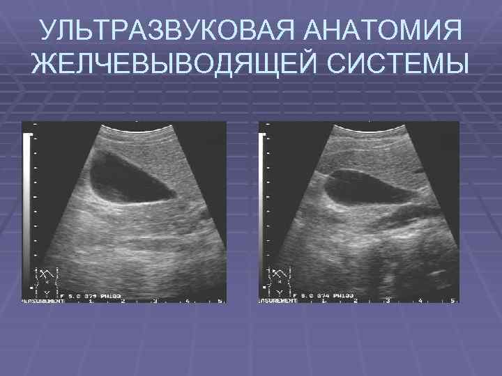 УЛЬТРАЗВУКОВАЯ АНАТОМИЯ ЖЕЛЧЕВЫВОДЯЩЕЙ СИСТЕМЫ 