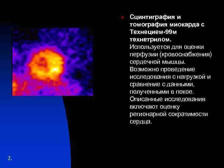 n 2. Сцинтиграфия и томография миокарда с Технецием-99 м технетрилом. Используется для оценки перфузии