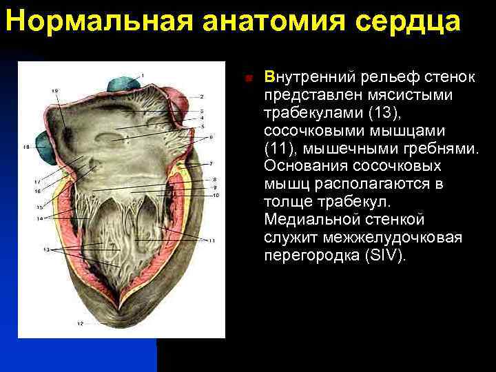Нормальная анатомия сердца n Внутренний рельеф стенок представлен мясистыми трабекулами (13), сосочковыми мышцами (11),