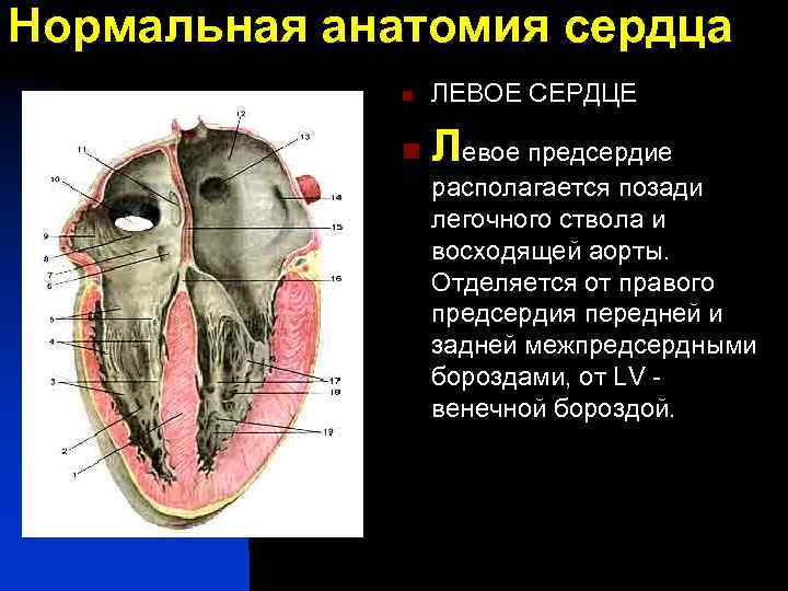 Нормальная анатомия сердца n ЛЕВОЕ СЕРДЦЕ n Левое предсердие располагается позади легочного ствола и