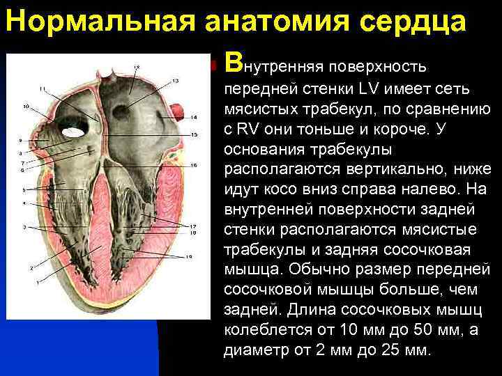 Нормальная анатомия сердца n Внутренняя поверхность передней стенки LV имеет сеть мясистых трабекул, по