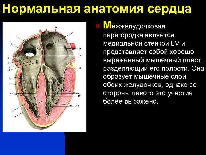 Нормальная анатомия сердца n Межжелудочковая перегородка является медиальной стенкой LV и представляет собой хорошо