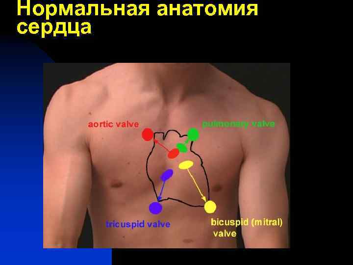 Нормальная анатомия сердца 