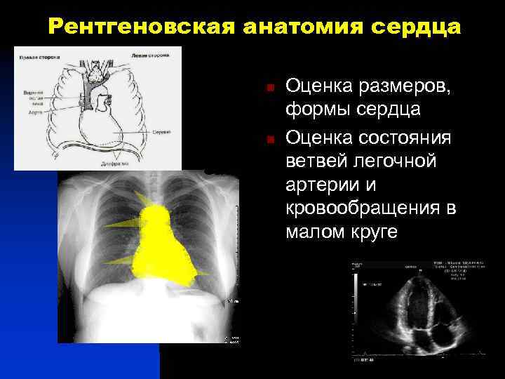 Рентгеновская анатомия сердца n n Оценка размеров, формы сердца Оценка состояния ветвей легочной артерии