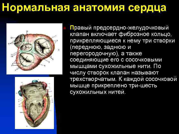 Нормальная анатомия сердца n Правый предсердно-желудочковый клапан включает фиброзное кольцо, прикрепляющиеся к нему три