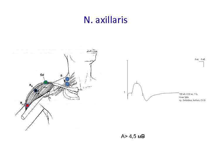 N. axillaris А> 4, 5 м. В 