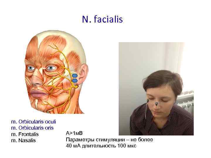 N. facialis m. Orbicularis oculi m. Orbicularis oris m. Frontalis m. Nasalis А>1 м.
