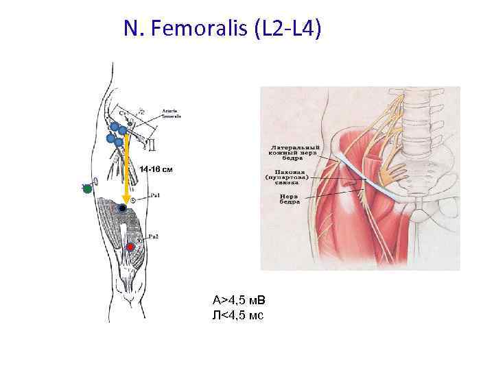 N. Femoralis (L 2 -L 4) 14 -16 см А>4, 5 м. В Л<4,