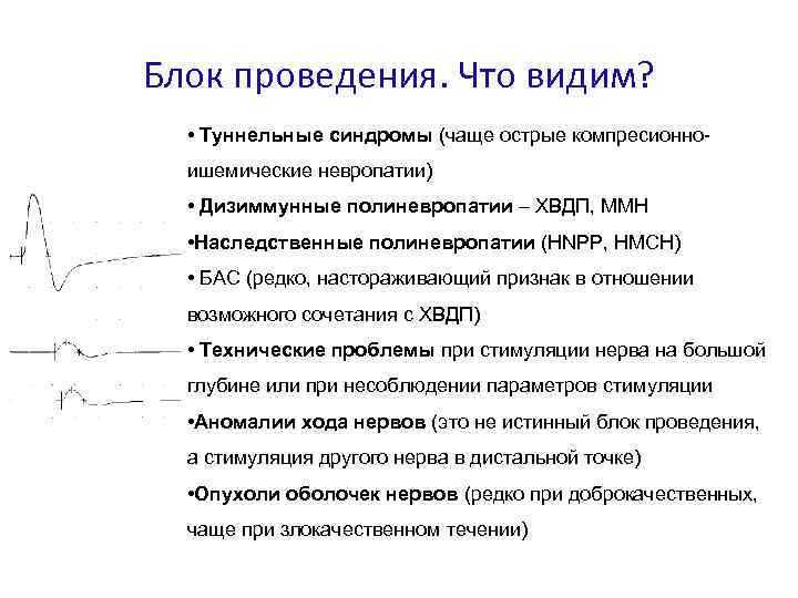 Блок проведения. Что видим? • Туннельные синдромы (чаще острые компресионноишемические невропатии) • Дизиммунные полиневропатии