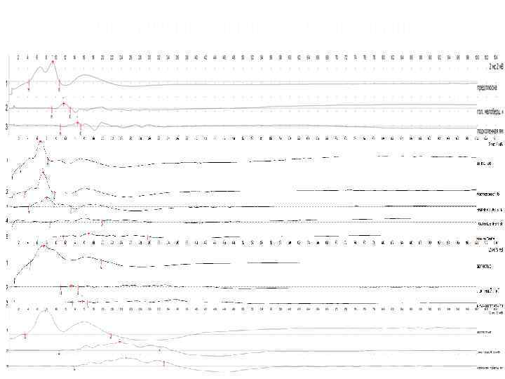 Электрофизиологическое обследование 