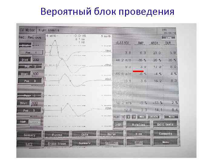 Вероятный блок проведения 