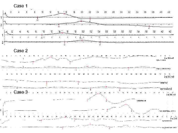 Case 1 Case 2 Case 3 