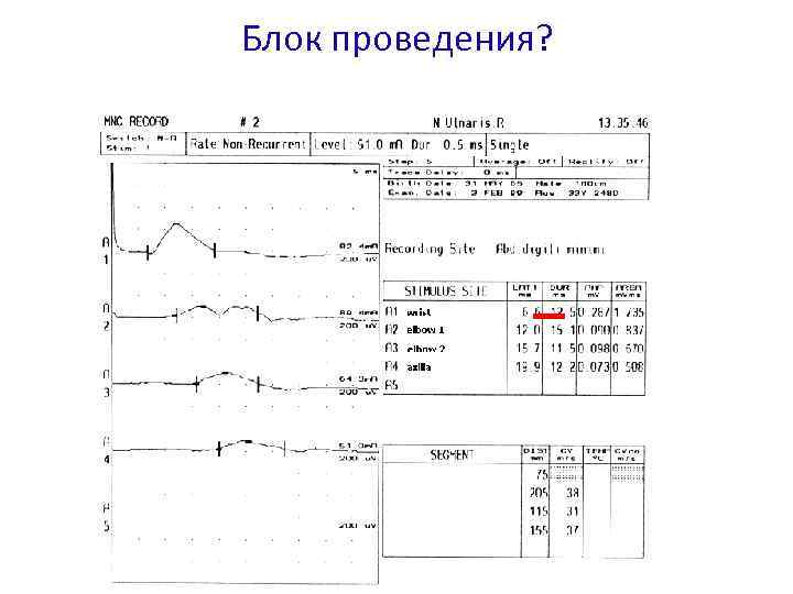 Блок проведения? 