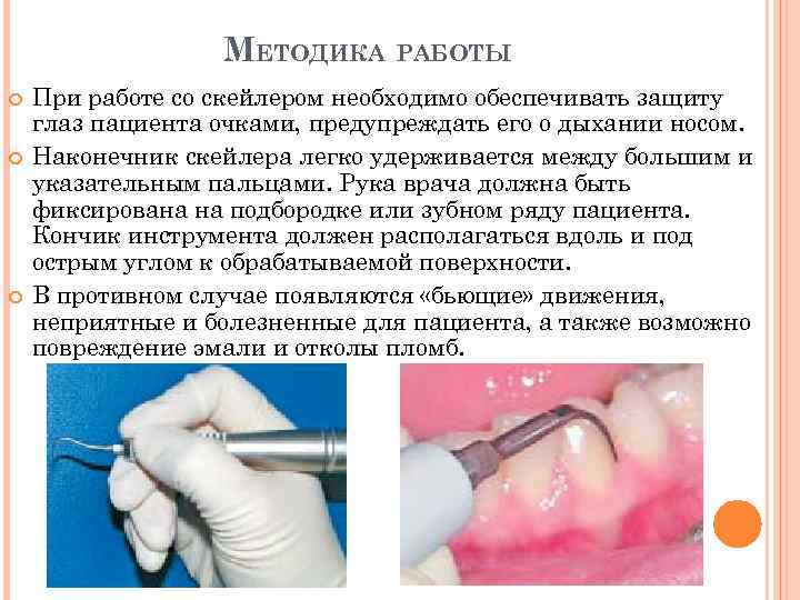 МЕТОДИКА РАБОТЫ При работе со скейлером необходимо обеспечивать защиту глаз пациента очками, предупреждать его