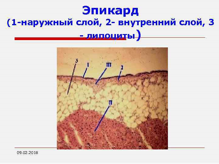 Эпикард (1 -наружный слой, 2 - внутренний слой, 3 - липоциты) 09. 02. 2018