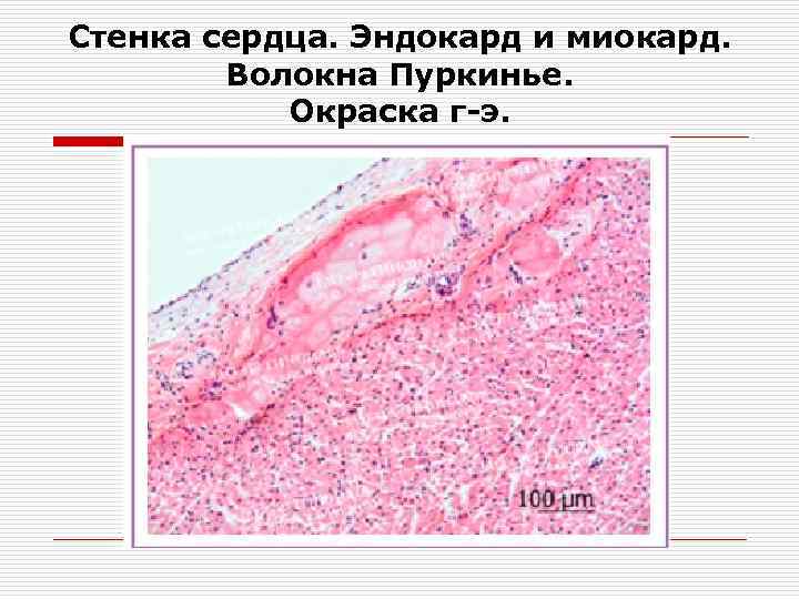 Сердце гистология рисунок - 83 фото