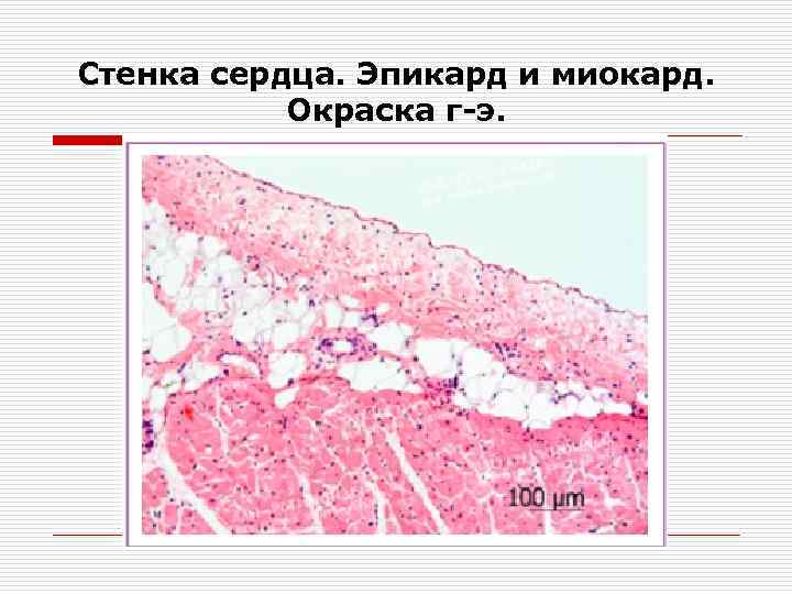 Сердце гистология рисунок - 83 фото