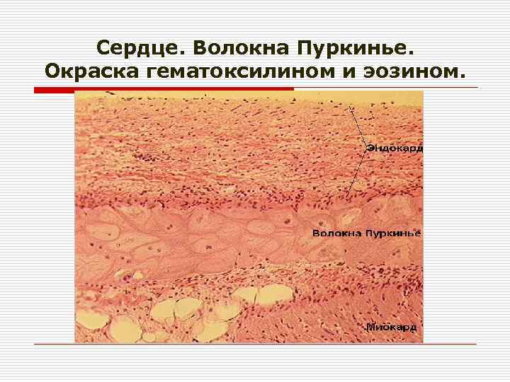 Волокна пуркинье гистология рисунок