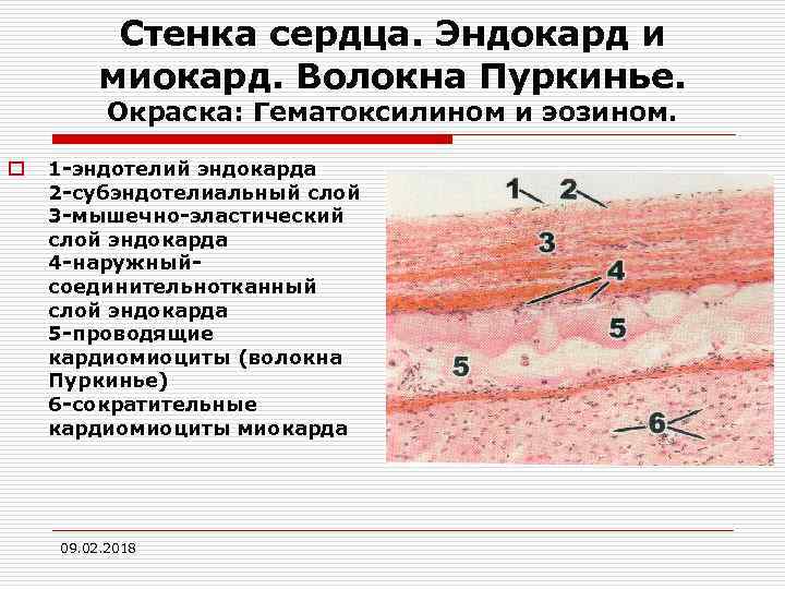 Срез стенки сердца рисунок - 91 фото