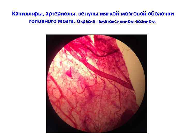 Капилляры, артериолы, венулы мягкой мозговой оболочки головного мозга. Окраска гематоксилином-эозином. 