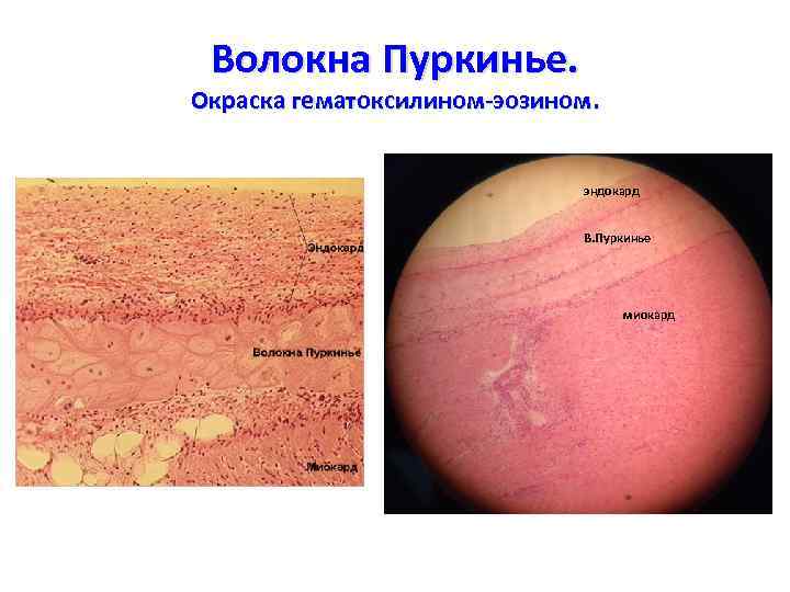 Волокна Пуркинье. Окраска гематоксилином-эозином. эндокард В. Пуркинье миокард 