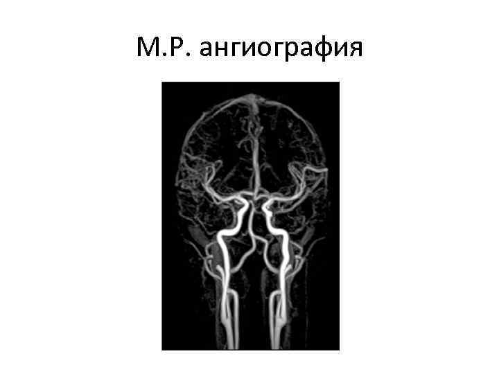 М. Р. ангиография 