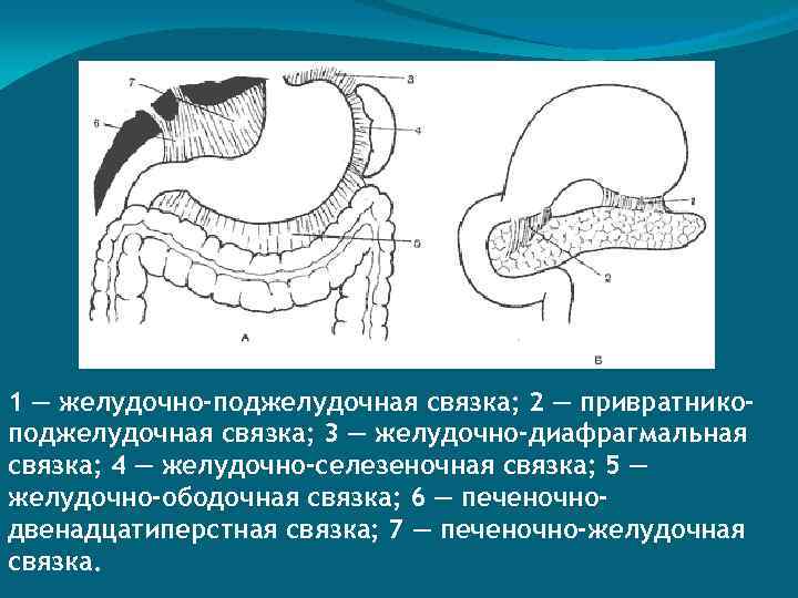 1 — желудочно-поджелудочная связка; 2 — привратникоподжелудочная связка; 3 — желудочно-диафрагмальная связка; 4 —