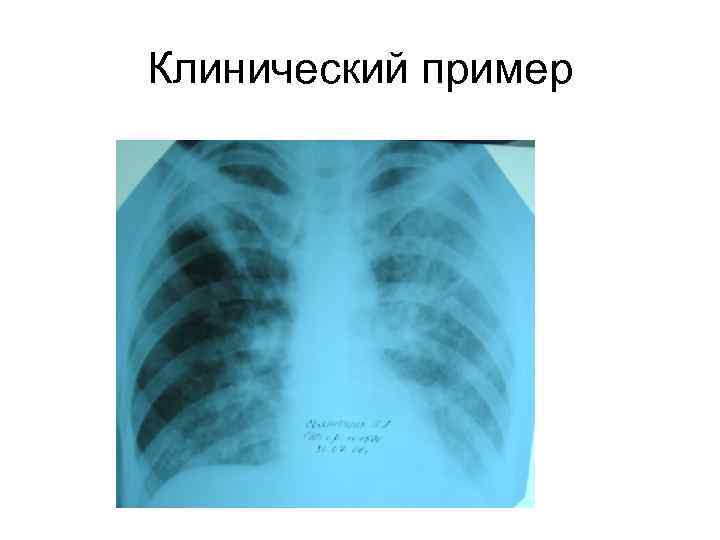 Клинический пример 