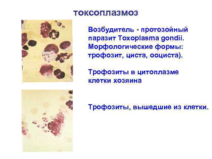 токсоплазмоз Возбудитель - протозойный паразит Toxoplasma gondii. Морфологические формы: трофозит, циста, ооциста). Трофозиты в
