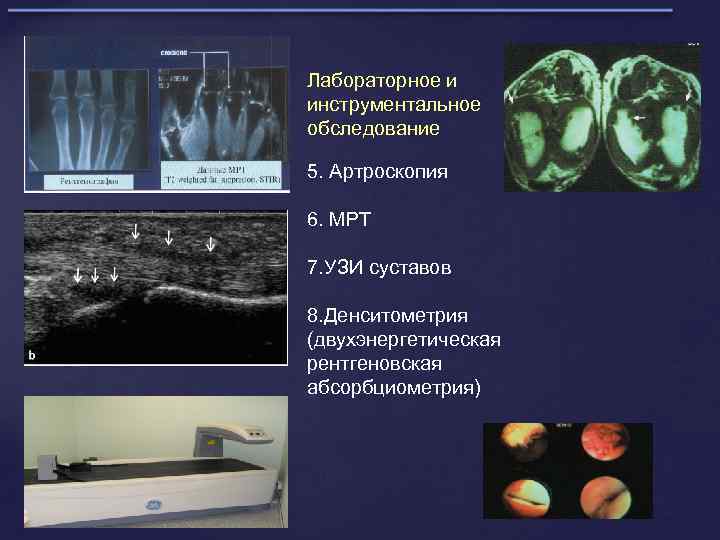 Лабораторное и инструментальное обследование 5. Артроскопия 6. МРТ 7. УЗИ суставов 8. Денситометрия (двухэнергетическая
