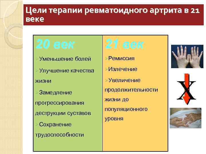 Цели терапии ревматоидного артрита в 21 веке 20 век 21 век ØУменьшение болей ØРемиссия