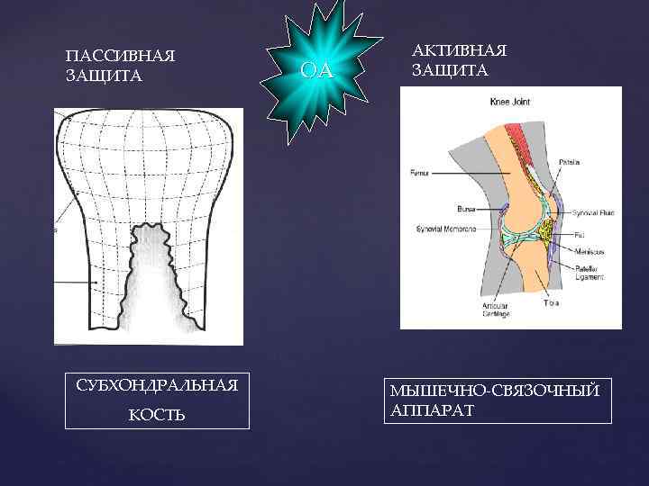 ПАССИВНАЯ ЗАЩИТА СУБХОНДРАЛЬНАЯ КОСТЬ ОА АКТИВНАЯ ЗАЩИТА МЫШЕЧНО-СВЯЗОЧНЫЙ АППАРАТ 
