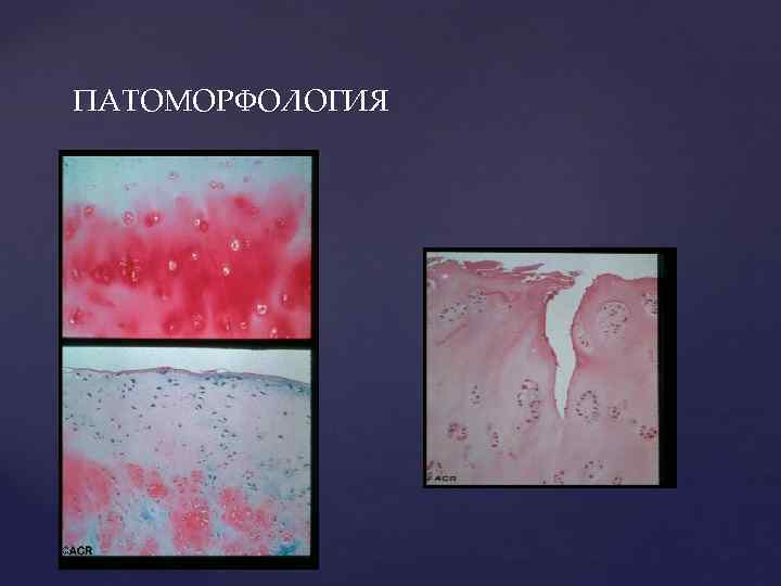 ПАТОМОРФОЛОГИЯ 
