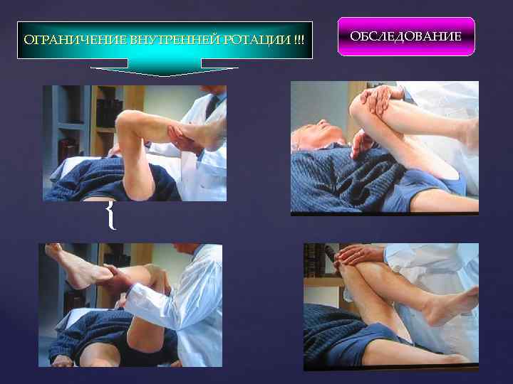 ОГРАНИЧЕНИЕ ВНУТРЕННЕЙ РОТАЦИИ !!! { ОБСЛЕДОВАНИЕ 