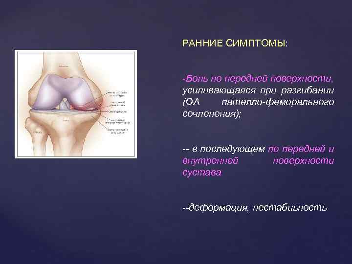 РАННИЕ СИМПТОМЫ: -Боль по передней поверхности, усиливающаяся при разгибании (ОА пателло-феморального сочленения); -- в