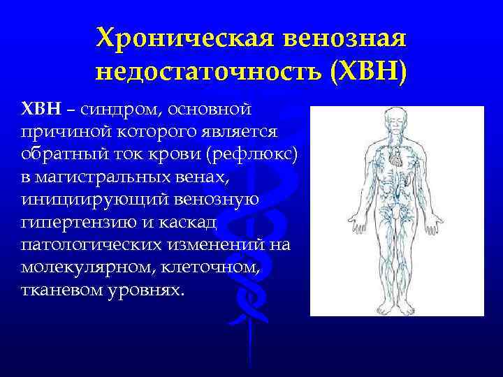 Хроническая венозная недостаточность (ХВН) ХВН – синдром, основной причиной которого является обратный ток крови