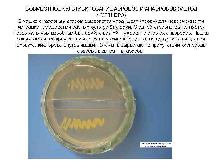 Среда для культивирования аэробов из образцов детской крови