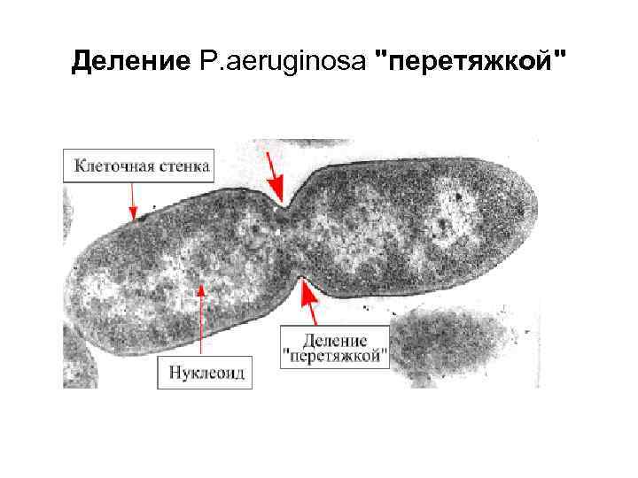 Деление P. aeruginosa "перетяжкой" 