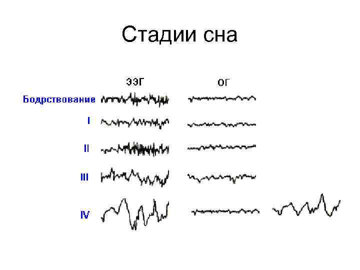 1 нарисовать схему стадий сна по данным ээг