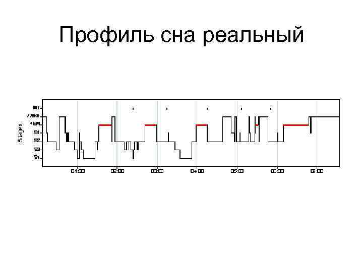 Профиль сна реальный 