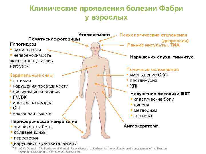 Симптомы болезни. Диагностические критерии болезни Фабри. Болезнь Фабри клинические проявления. Болезнь Андерсона Фабри. Ангиокератомы болезнь Фабри.