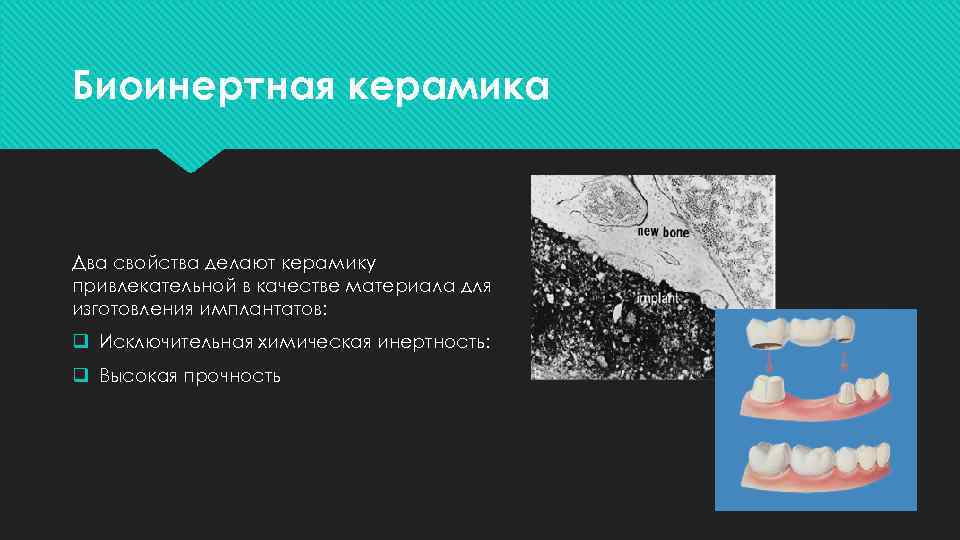 Биоинертная керамика Два свойства делают керамику привлекательной в качестве материала для изготовления имплантатов: q