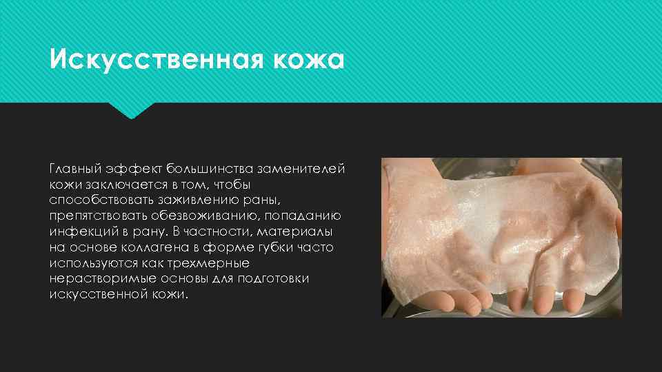 Искусственная кожа Главный эффект большинства заменителей кожи заключается в том, чтобы способствовать заживлению раны,