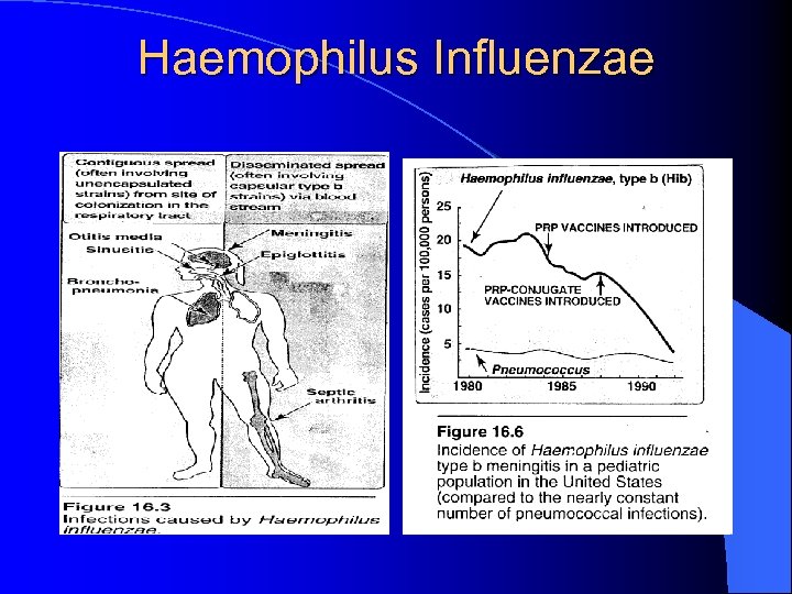 Haemophilus Influenzae 