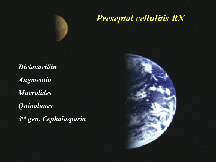 Preseptal cellulitis RX Dicloxacillin Augmentin Macrolides Quinolones 3 rd gen. Cephalosporin 