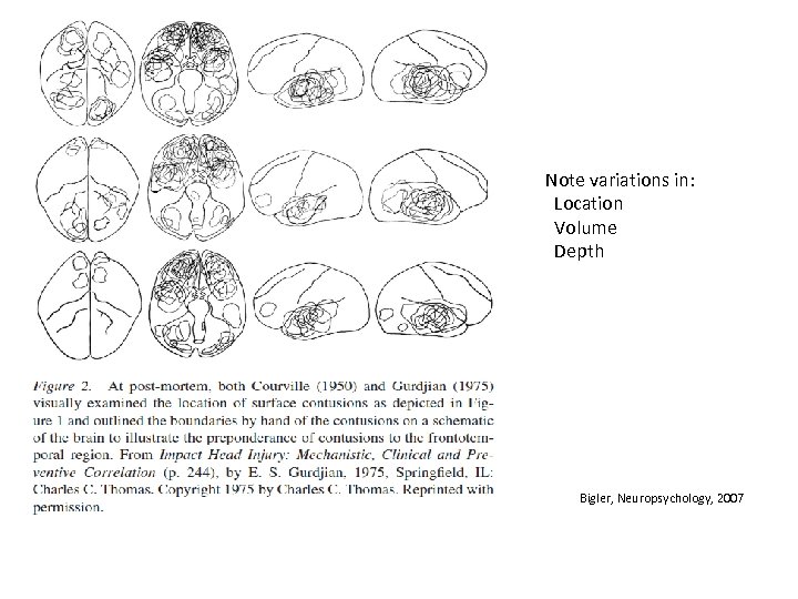 Note variations in: Location Volume Depth Bigler, Neuropsychology, 2007 