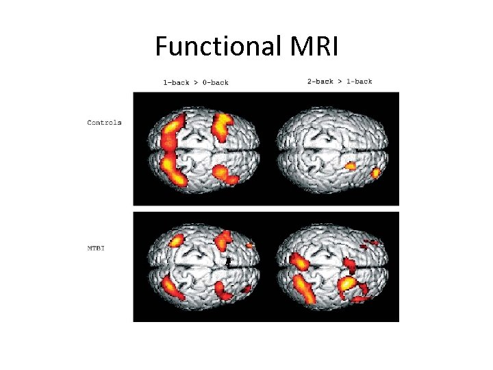 Functional MRI 